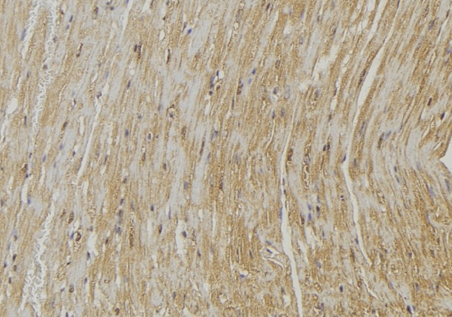 PLOD2 Antibody - 1:100 staining mouse muscle tissue by IHC-P. The sample was formaldehyde fixed and a heat mediated antigen retrieval step in citrate buffer was performed. The sample was then blocked and incubated with the antibody for 1.5 hours at 22°C. An HRP conjugated goat anti-rabbit antibody was used as the secondary.