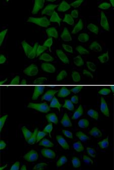 PLOD2 Antibody - Immunofluorescence analysis of U2OS cells using PLOD2 Polyclonal Antibody.