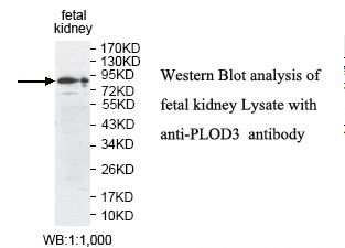 PLOD3 Antibody