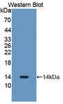 PLOD3 Antibody - Western blot of PLOD3 antibody.