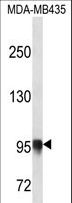 PLOD3 Antibody - PLOD3 Antibody western blot of MDA-MB435 cell line lysates (35 ug/lane). The PLOD3 antibody detected the PLOD3 protein (arrow).