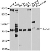 PLOD3 Antibody - Western blot analysis of extracts of various cell lines, using PLOD3 antibody at 1:1000 dilution. The secondary antibody used was an HRP Goat Anti-Rabbit IgG (H+L) at 1:10000 dilution. Lysates were loaded 25ug per lane and 3% nonfat dry milk in TBST was used for blocking. An ECL Kit was used for detection and the exposure time was 15s.