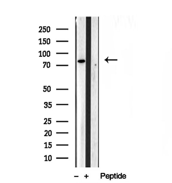 PLOD3 Antibody - Western blot analysis of extracts of HepG2 cells using PLOD3 antibody.