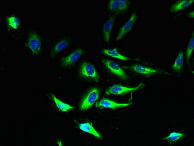 PLP1 / Myelin PLP Antibody - Immunofluorescent analysis of Hela cells using PLP1 Antibody at dilution of 1:100 and Alexa Fluor 488-congugated AffiniPure Goat Anti-Rabbit IgG(H+L)