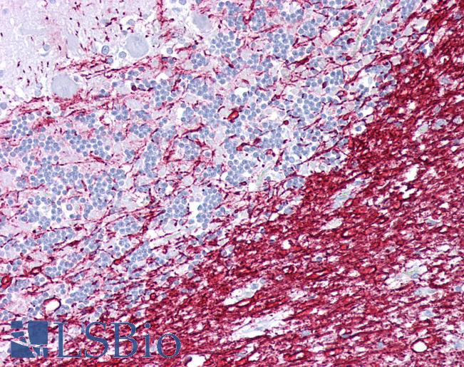 PLP1 / Myelin PLP Antibody - Anti-PLP1 antibody IHC of human brain, cerebellum. Immunohistochemistry of formalin-fixed, paraffin-embedded tissue after heat-induced antigen retrieval. Antibody concentration 5 ug/ml.  This image was taken for the unconjugated form of this product. Other forms have not been tested.