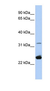 PLP1 / Myelin PLP Antibody - PLP1 antibody Western blot of HeLa lysate. This image was taken for the unconjugated form of this product. Other forms have not been tested.