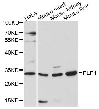 PLP1 / Myelin PLP Antibody - Western blot analysis of extracts of various cell lines, using PLP1 antibody at 1:3000 dilution. The secondary antibody used was an HRP Goat Anti-Rabbit IgG (H+L) at 1:10000 dilution. Lysates were loaded 25ug per lane and 3% nonfat dry milk in TBST was used for blocking. An ECL Kit was used for detection and the exposure time was 90s.