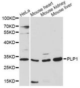 PLP1 / Myelin PLP Antibody - Western blot analysis of extracts of various cell lines, using PLP1 antibody at 1:3000 dilution. The secondary antibody used was an HRP Goat Anti-Rabbit IgG (H+L) at 1:10000 dilution. Lysates were loaded 25ug per lane and 3% nonfat dry milk in TBST was used for blocking. An ECL Kit was used for detection and the exposure time was 90s.
