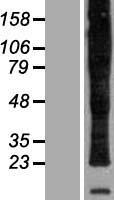 PLP1 / Myelin PLP Protein - Western validation with an anti-DDK antibody * L: Control HEK293 lysate R: Over-expression lysate