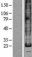 PLP1 / Myelin PLP Protein - Western validation with an anti-DDK antibody * L: Control HEK293 lysate R: Over-expression lysate