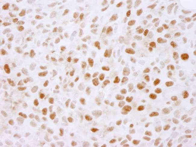 PLRG1 Antibody - Detection of Mouse PLRG1 by Immunohistochemistry. Sample: FFPE section of mouse squamous cell carcinoma. Antibody: Affinity purified rabbit anti-PLRG1 used at a dilution of 1:100.