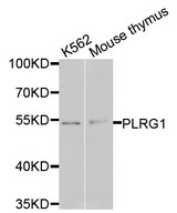 PLRG1 Antibody - Western blot analysis of extracts of various cells.
