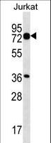 PLS1 / Fimbrin Antibody - PLS1 Antibody western blot of Jurkat cell line lysates (35 ug/lane). The PLS1 antibody detected the PLS1 protein (arrow).