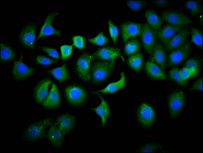 PLS1 / Fimbrin Antibody - Immunofluorescence staining of A549 cells diluted at 1:133, counter-stained with DAPI. The cells were fixed in 4% formaldehyde, permeabilized using 0.2% Triton X-100 and blocked in 10% normal Goat Serum. The cells were then incubated with the antibody overnight at 4°C.The Secondary antibody was Alexa Fluor 488-congugated AffiniPure Goat Anti-Rabbit IgG (H+L).