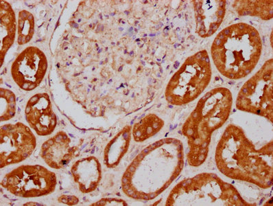 PLS1 / Fimbrin Antibody - Immunohistochemistry Dilution at 1:400 and staining in paraffin-embedded human kidney tissue performed on a Leica BondTM system. After dewaxing and hydration, antigen retrieval was mediated by high pressure in a citrate buffer (pH 6.0). Section was blocked with 10% normal Goat serum 30min at RT. Then primary antibody (1% BSA) was incubated at 4°C overnight. The primary is detected by a biotinylated Secondary antibody and visualized using an HRP conjugated SP system.