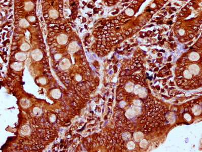 PLS1 / Fimbrin Antibody - Immunohistochemistry Dilution at 1:400 and staining in paraffin-embedded human small intestine tissue performed on a Leica BondTM system. After dewaxing and hydration, antigen retrieval was mediated by high pressure in a citrate buffer (pH 6.0). Section was blocked with 10% normal Goat serum 30min at RT. Then primary antibody (1% BSA) was incubated at 4°C overnight. The primary is detected by a biotinylated Secondary antibody and visualized using an HRP conjugated SP system.