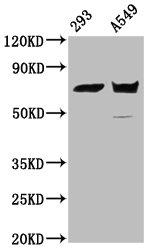PLS1 / Fimbrin Antibody - Western Blot Positive WB detected in: 293 whole cell lysate, A549 whole cell lysate All Lanes: PLS1 antibody at 5.2µg/ml Secondary Goat polyclonal to rabbit IgG at 1/50000 dilution Predicted band size: 71 KDa Observed band size: 71 KDa