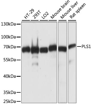 PLS1 / Fimbrin Antibody - Western blot analysis of extracts of various cell lines, using PLS1 antibody at 1:1000 dilution. The secondary antibody used was an HRP Goat Anti-Rabbit IgG (H+L) at 1:10000 dilution. Lysates were loaded 25ug per lane and 3% nonfat dry milk in TBST was used for blocking. An ECL Kit was used for detection and the exposure time was 3s.