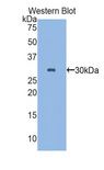 PLS3 / T Plastin Antibody - Western blot of recombinant PLS3 / T Plastin.  This image was taken for the unconjugated form of this product. Other forms have not been tested.