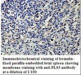 PLS3 / T Plastin Antibody
