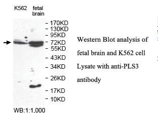 PLS3 / T Plastin Antibody