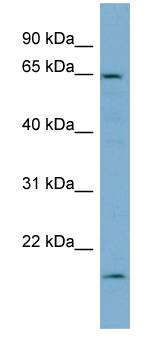 PLS3 / T Plastin Antibody - Western analysis of HT1080 cell lysate.  This image was taken for the unconjugated form of this product. Other forms have not been tested.