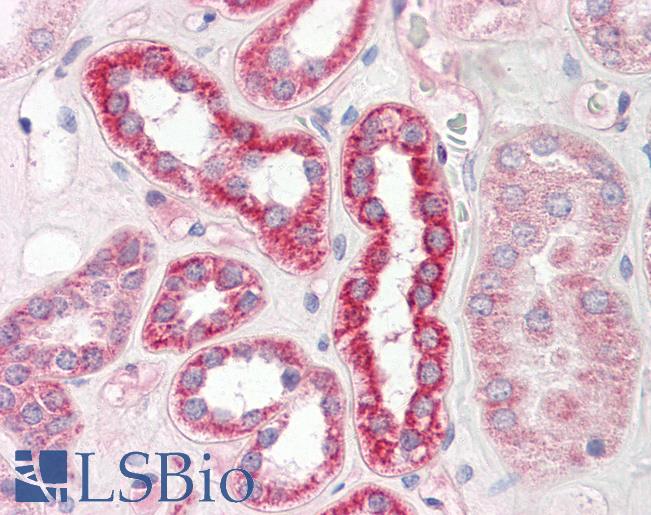 PLS3 / T Plastin Antibody - Anti-PLS3 / T Plastin antibody IHC of human kidney. Immunohistochemistry of formalin-fixed, paraffin-embedded tissue after heat-induced antigen retrieval. Antibody dilution 5-7.5 ug/ml.  This image was taken for the unconjugated form of this product. Other forms have not been tested.