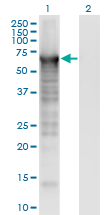 PLS3 / T Plastin Antibody - Western Blot analysis of PLS3 expression in transfected 293T cell line by PLS3 monoclonal antibody (M01), clone 5B9.Lane 1: PLS3 transfected lysate (Predicted MW: 70.8 KDa).Lane 2: Non-transfected lysate.