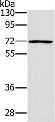 PLS3 / T Plastin Antibody - Western blot analysis of Raji cell, using PLS3 Polyclonal Antibody at dilution of 1:400.