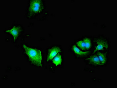 PLS3 / T Plastin Antibody - Immunofluorescent analysis of MCF-7 cells diluted at 1:100 and Alexa Fluor 488-congugated AffiniPure Goat Anti-Rabbit IgG(H+L)