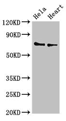 PLS3 / T Plastin Antibody - Western Blot Positive WB detected in:Hela whole cell lysate,Mouse heart tissue All Lanes:PLS3 antibody at 3.4µg/ml Secondary Goat polyclonal to rabbit IgG at 1/50000 dilution Predicted band size: 71,70,66 KDa Observed band size: 71 KDa