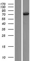 PLS3 / T Plastin Protein - Western validation with an anti-DDK antibody * L: Control HEK293 lysate R: Over-expression lysate