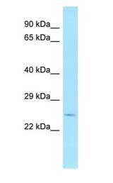 PLSCR2 Antibody - PLSCR2 antibody Western Blot of Fetal Heart.  This image was taken for the unconjugated form of this product. Other forms have not been tested.