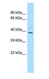 PLSCR4 Antibody - PLSCR4 antibody Western Blot of Fetal Lung.  This image was taken for the unconjugated form of this product. Other forms have not been tested.