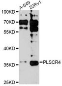 PLSCR4 Antibody - Western blot analysis of extracts of various cell lines, using PLSCR4 antibody at 1:3000 dilution. The secondary antibody used was an HRP Goat Anti-Rabbit IgG (H+L) at 1:10000 dilution. Lysates were loaded 25ug per lane and 3% nonfat dry milk in TBST was used for blocking. An ECL Kit was used for detection and the exposure time was 90s.