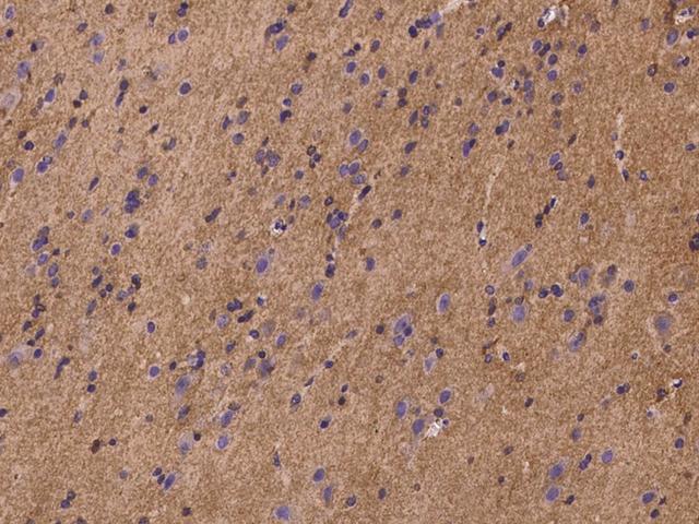 PLSCR4 Antibody - Immunochemical staining of human PLSCR4 in human brain with rabbit polyclonal antibody at 1:100 dilution, formalin-fixed paraffin embedded sections.