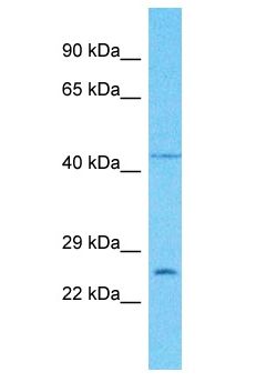 PLSCR5 Antibody - PLSCR5 antibody Western Blot of HCT15. Antibody dilution: 1 ug/ml.  This image was taken for the unconjugated form of this product. Other forms have not been tested.