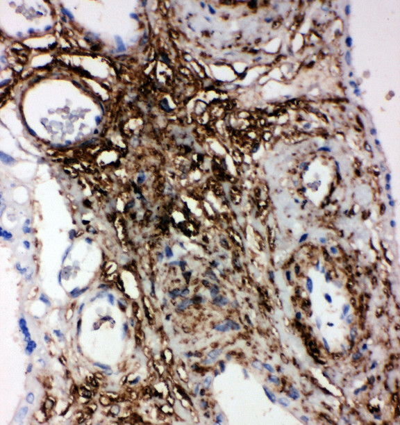 PLTP Antibody - PLTP antibody. IHC(P): Human Placenta Tissue.
