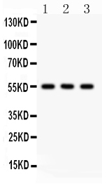 PLTP Antibody - Anti-PLTP antibody,Western blotting All lanes: Anti PLTP at 0.5ug/ml Lane 1: MCF-7 Whole Cell Lysate at 40ugLane 2: RAJI Whole Cell Lysate at 40ugLane 3: HELA Whole Cell Lysate at 40ugPredicted bind size: 55KD Observed bind size: 55KD