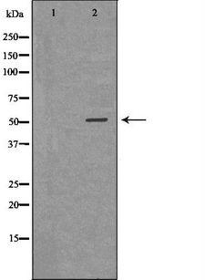 PLTP Antibody - Western blot analysis of 293T whole cells lysates using PLTP antibody. The lane on the left is treated with the antigen-specific peptide.