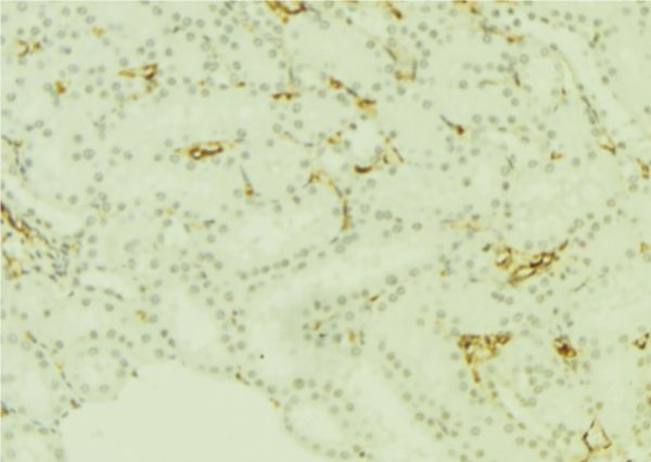 PLTP Antibody - 1:100 staining mouse kidney tissue by IHC-P. The sample was formaldehyde fixed and a heat mediated antigen retrieval step in citrate buffer was performed. The sample was then blocked and incubated with the antibody for 1.5 hours at 22°C. An HRP conjugated goat anti-rabbit antibody was used as the secondary.