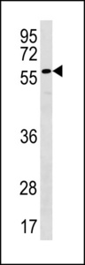 PLXDC2 Antibody - PLXDC2 Antibody western blot of NCI-H292 cell line lysates (35 ug/lane). The PLXDC2 antibody detected the PLXDC2 protein (arrow).