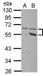 PLXDC2 Antibody - Sample (30 ug of whole cell lysate) A: HeLa B: HepG2 10% SDS PAGE PLXDC2 antibody diluted at 1:1000