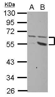 PLXDC2 Antibody - Sample (30 ug of whole cell lysate) A: HeLa B: HepG2 10% SDS PAGE PLXDC2 antibody diluted at 1:1000