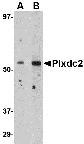 PLXDC2 Antibody - Western blot of Plxdc2 in human brain tissue lysate with Plxdc2 antibody at (A) 0.5 (B) 1 ug/ml.