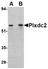 PLXDC2 Antibody - Western blot of Plxdc2 in human colon tissue lysate with Plxdc2 antibody at (A) 0.5 (B) 1 ug/ml.