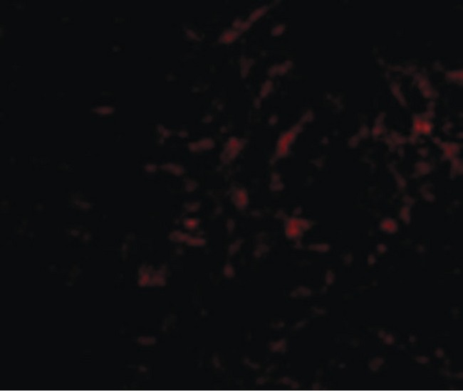 PLXDC2 Antibody - Immunofluorescence of Plxdc2 in Human Brain cells with Plxdc2 antibody at 50 ug/ml.