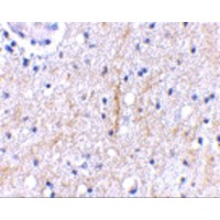 PLXDC2 Antibody - Immunohistochemical staining of human brain tissue using Plxdc2 antibody at 2.5 µg/mL.