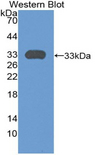 PLXNA1 / Plexin A1 Antibody - Western blot of recombinant PLXNA1 / Plexin A1.