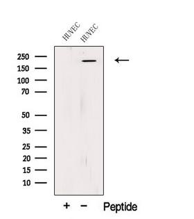 PLXNA1 / Plexin A1 Antibody - Western blot analysis of extracts of HuvEc cells using PLXA1 antibody. The lane on the left was treated with blocking peptide.